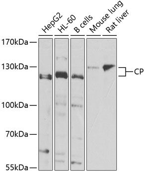 CP Rabbit Polyclonal Antibody[