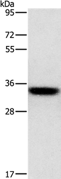 HOXB13 Antibody[35768]