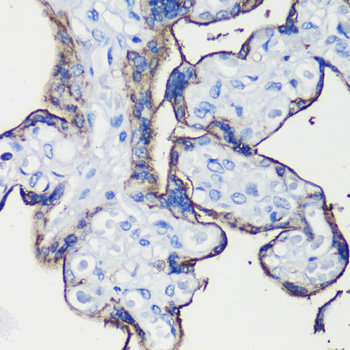 E-Cadherin Rabbit Polyclonal A