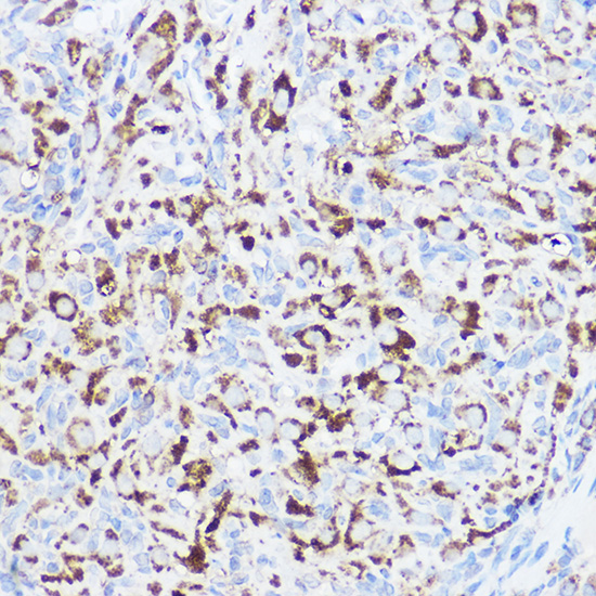 MGLL antibody[39074]