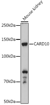 CARD10 Rabbit Polyclonal Antib