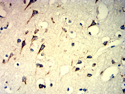 M6PR Mouse mAb[63892]