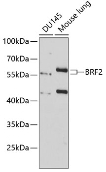BRF2 Rabbit Polyclonal Antibod