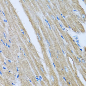 CCM2 Rabbit Polyclonal Antibod