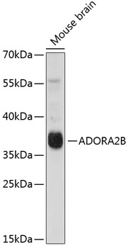 ADORA2B Rabbit Polyclonal Anti