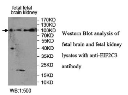 EIF2C3 Antibody[39952]