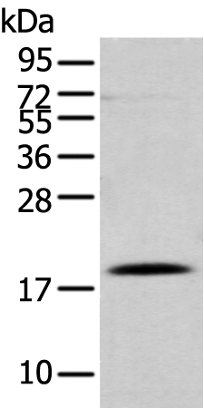 DAND5 Antibody[43367]