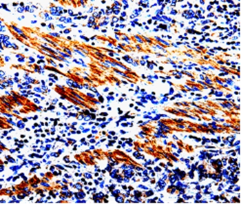 ACSBG2 Antibody[35552]
