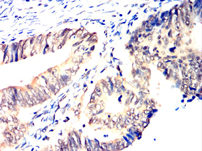 HNF1B Mouse mAb[63742]