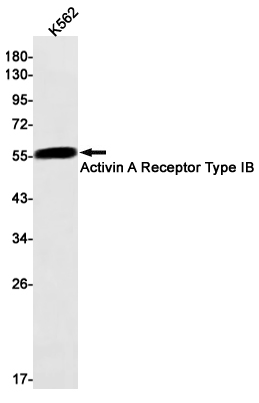 Activin A Receptor Type IB Rab