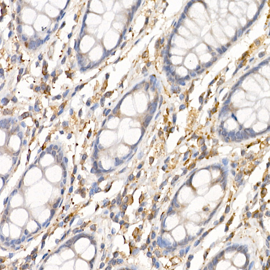 C19orf10 antibody[38186]