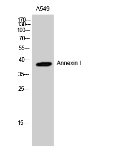 Annexin I Polyclonal Antibody[