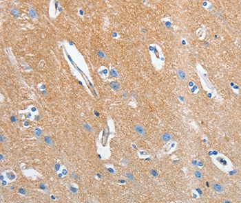 SEPT9 Antibody[35642]