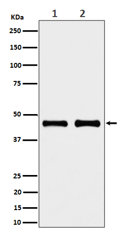 NDUFS2 Rabbit mAb[57126]