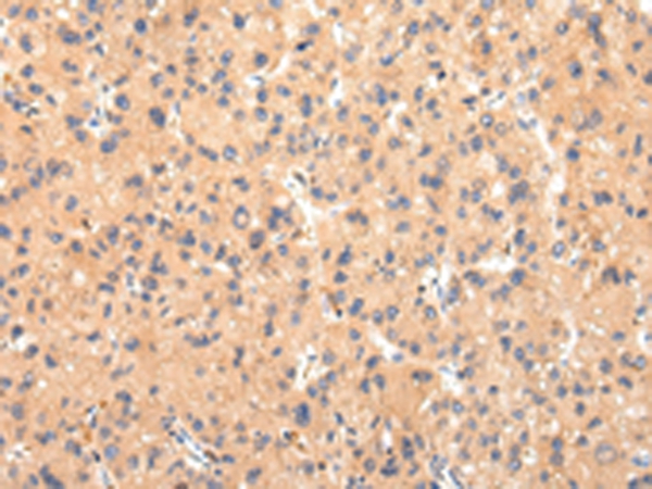 ATP7B  Antibody[43445]