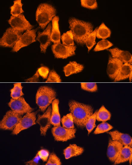 RPS3 Rabbit Polyclonal Antibod