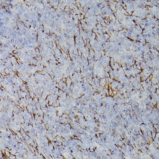 PDGFRA antibody[38364]