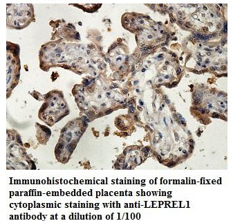 LEPREL1 Antibody[39880]