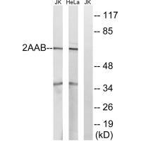 PPP2R1B Antibody[35031]