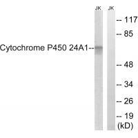 Cytochrome P450 24A1 Antibody[