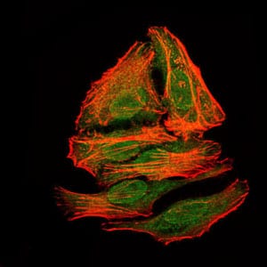 mouse Splunc2 Mouse mAb[63942]
