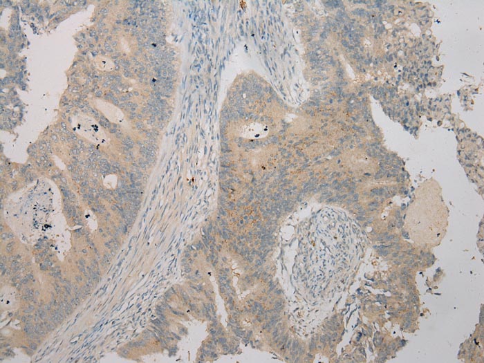 TSPY1 Antibody[40270]