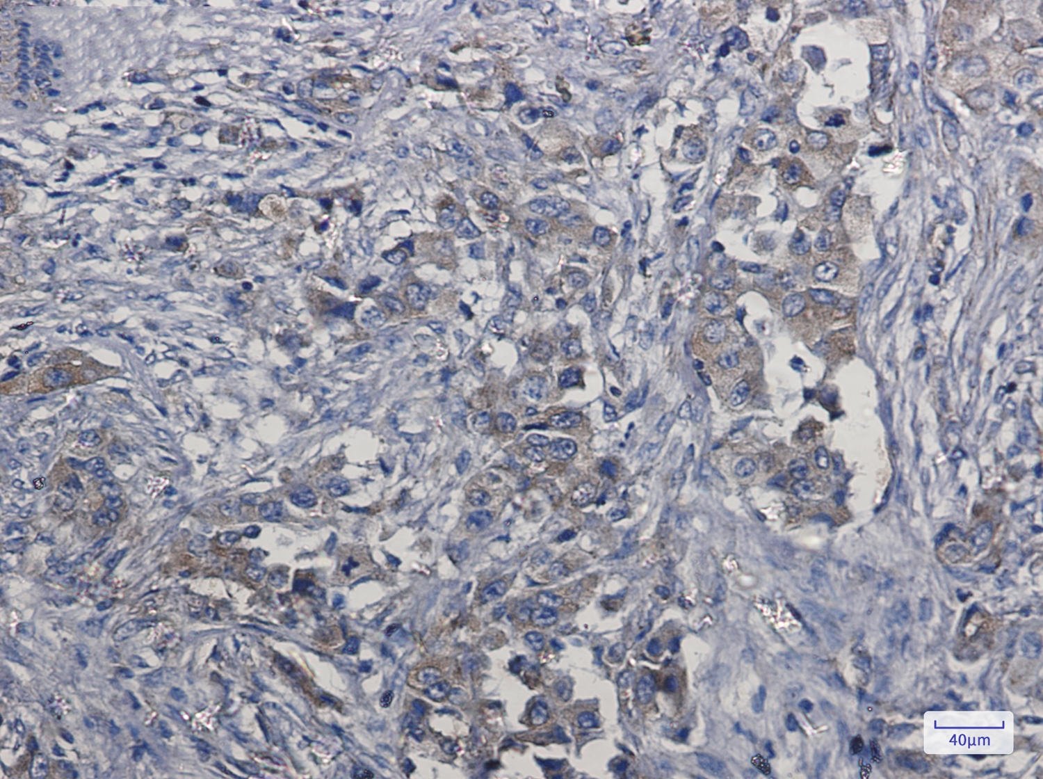 c Met Rabbit mAb[52414]