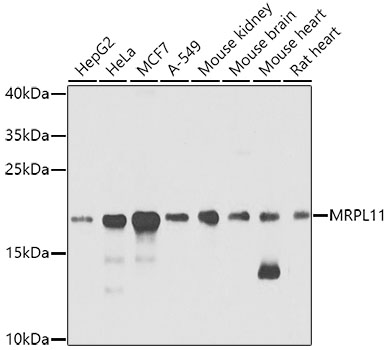 MRPL11 Rabbit Polyclonal Antib
