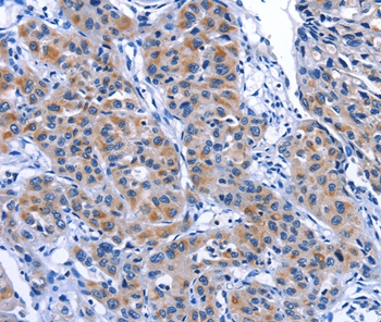 MYH1 Antibody[35828]