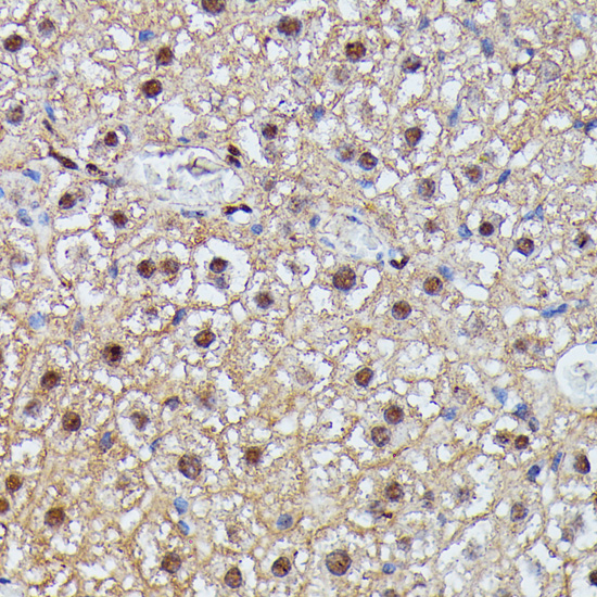 IGHMBP2 Rabbit Polyclonal Anti