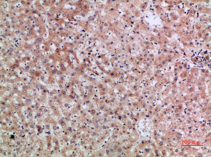 ERLIN1/2 Polyclonal Antibody[4