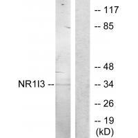 NR1I3 Antibody[33887]