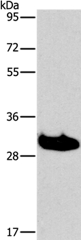 LAIR1 Antibody[35800]