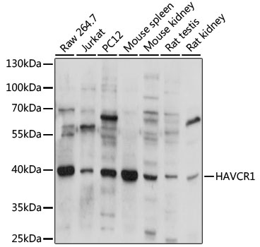 HAVCR1 Rabbit Polyclonal Antib