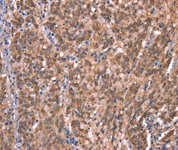 GCSAM Antibody[37588]