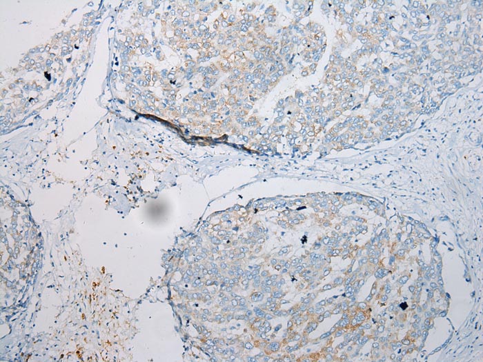 CCL7 Antibody[43233]