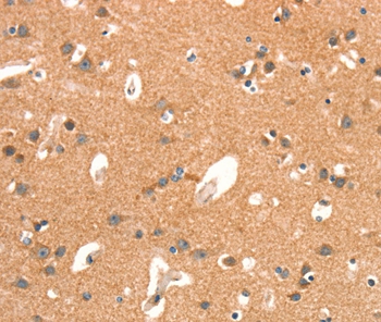 ARHGAP4 Antibody[37353]