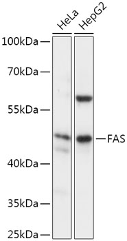 FAS Rabbit Polyclonal Antibody