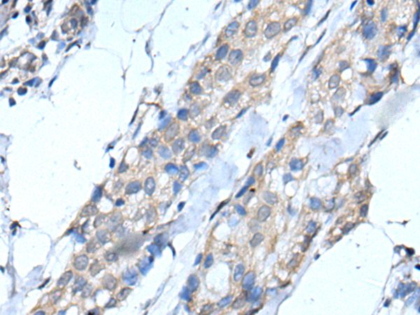 SCNN1G Antibody[43516]
