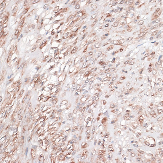 LAMC1 Rabbit Polyclonal Antibo