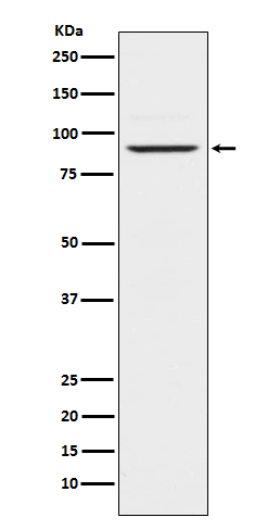 Prolactin Receptor Rabbit mAb[