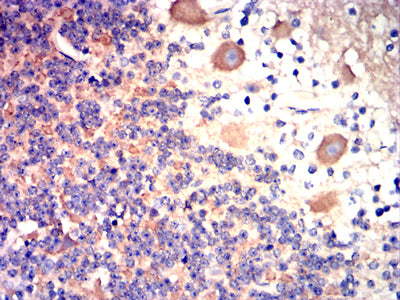 BRAF Mouse mAb[63162]