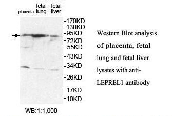 LEPREL1 Antibody[39880]