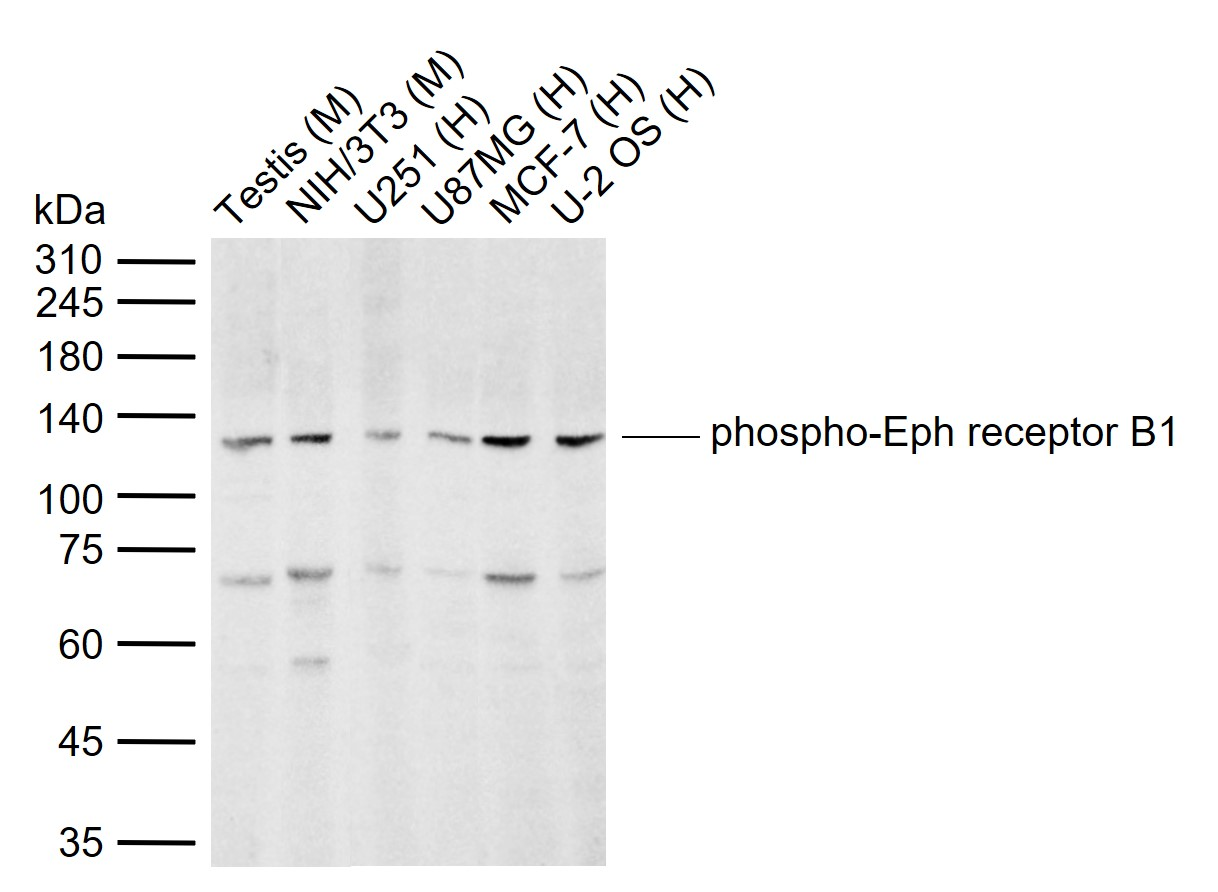 EPHB1 (Phospho-Tyr928) Antibod