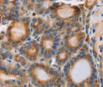 RIPK4 Antibody[37870]