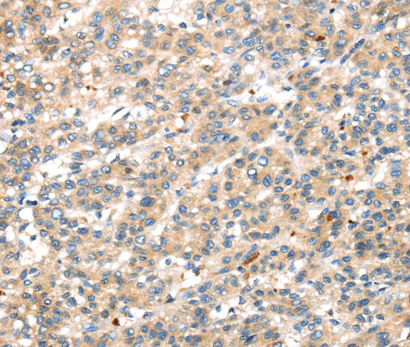 DDK1 Antibody[40397]