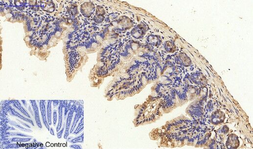 PKC Polyclonal Antibody[41347]