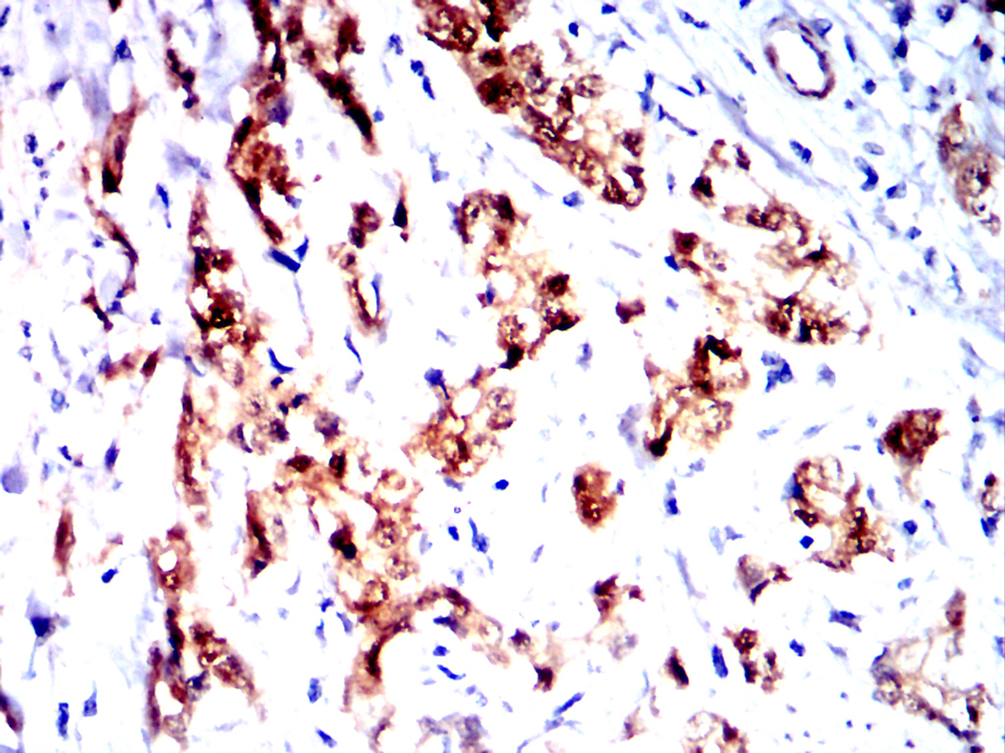AKR1C1 Mouse mAb[63040]