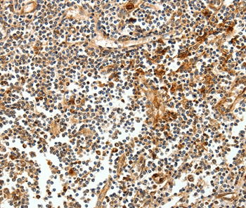 CEACAM21 Antibody[35679]