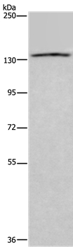 ITGAE Antibody[36557]